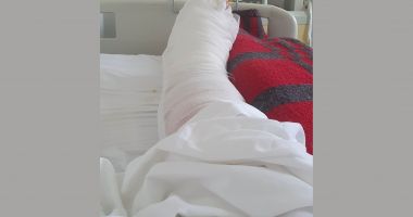 Mărturii ale femeii lovite de excavator, în centrul Constanței. "Am piciorul strivit! La o oră după accident, au acoperit groapa!" - 3