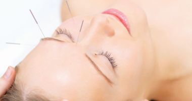 Stire din Sănătate : Acupunctura, aliatul principal împotriva durerii