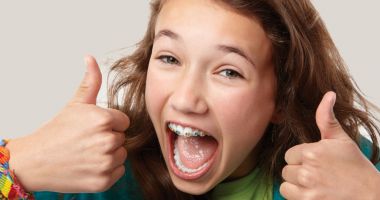 Stire din Sănătate : Vreți să aveți un zâmbet frumos? Aparatele dentare vă pot ajuta!