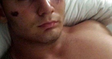"Au vrut să-mi înfigă cuțitul în cap! M-au lăsat pe jumătate inconștient" - 2