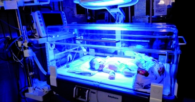 Stire din Sănătate : Cauzele icterului la nou-născuți. Cât de grave pot fi complicațiile