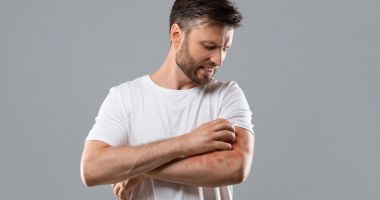 Stire din Sănătate : Afecţiunile pielii nu sunt grave, dar sunt deranjante