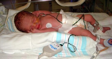 Stire din Sănătate : Alarmant la Constanța! Nașterile premature, un fenomen care a luat amploare
