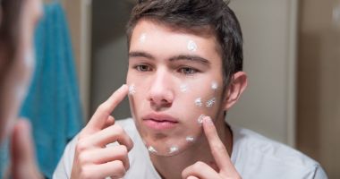 Stire din Sănătate : Acneea a lăsat urme pe fața dumneavoastră? Scăpați de ele în câțiva pași