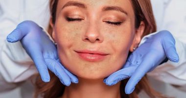 Stire din Sănătate : Terapia fotodinamică, de mare ajutor în tratarea afecţiunilor dermatologice