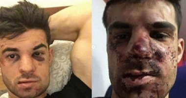 Stire din Sport : Un fotbalist a fost bătut cu bestialitate din cauza unui loc de parcare