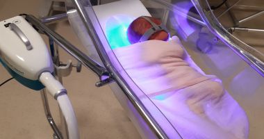 Stire din Sănătate : Fototerapia este indicată în cazul icterului la copii