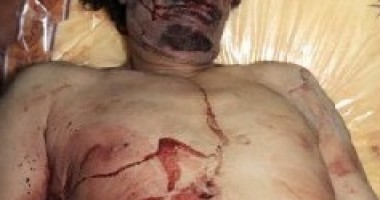 Noi imagini terifiante cu cadavrul lui Gaddafi / IMAGINI ȘOCANTE - 2