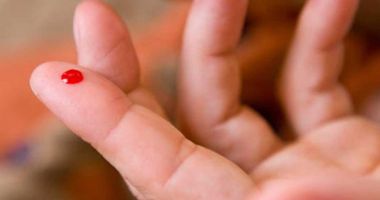 Stire din Sănătate : Hemofilia apare când există o deficienţă a factorilor de coagulare