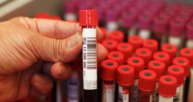 Stire din Sănătate : Analiză nouă, pe lista investigațiilor medicale gratuite