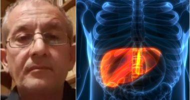 Stire din Social : Doctor Cătălin Apostolescu explică diferenţa dintre hepatita misterioasă şi boala Wilson
