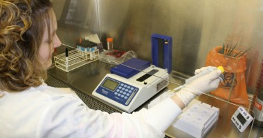Stire din Sănătate : Măsuri de prevenire a hepatitei A