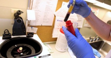 Stire din Sănătate : Testează-te pentru hepatită!