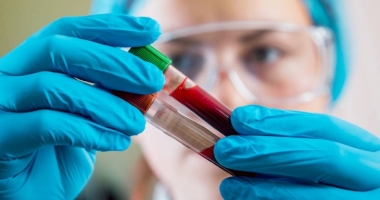 Cum se transmite hepatita virală C