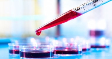 Stire din Sănătate : Cum poate fi prevenită hepatita virală E