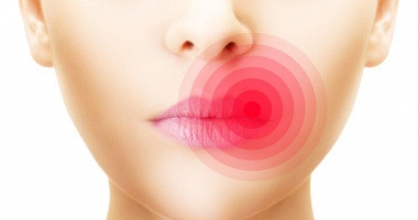 Stire din Sănătate : SUFERI DE HERPES? ÎN SFÂRȘIT, UN REMEDIU EFICIENT