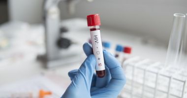 Stire din Actualitate : A fost descoperit al doilea pacient care s-a vindecat de HIV fără tratament