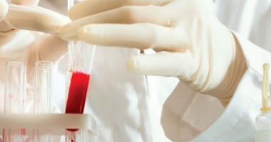 Stire din Sănătate : ALARMANT! Consumul de etnobotanice a dus la creșterea numărului de tineri infectați cu HIV
