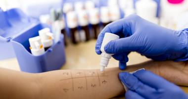 Stire din Sănătate : Alergia cu efect întârziat. Pericol pentru imunitate?