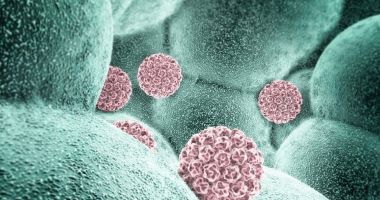 Stire din Social : INSP: În România, 13,7% din cancerele diagnosticate sunt asociate infecţiei cu HPV