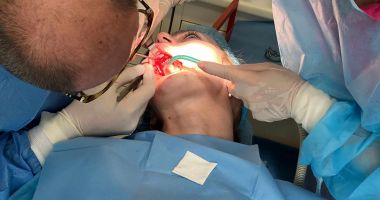 Implantul subperiostal realizat de specialiștii M&M Dental Team vă redă zâmbetul - 2