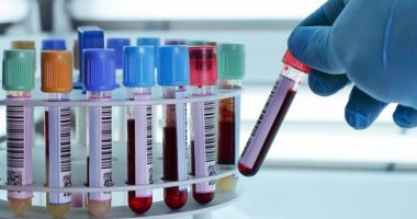 Stire din Social : Este alertă în România! O femeie a decedat din cauza virusului West Nile