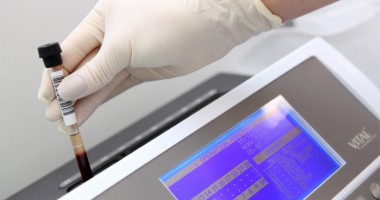 Stire din Sănătate : Sânge artificial creat de cercetători clujeni. Rezultate încurajatoare!