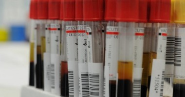 Stire din Sănătate : Descoperire revoluționară în medicină, ascunsă de medici