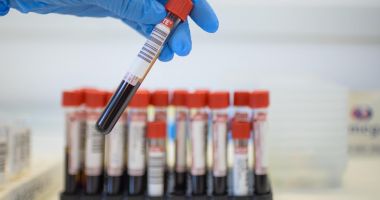 Cum putem preveni apariția hepatitei C