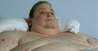 Stire din Sănătate : RADIOGRAFIA unui om de 450 DE KILOGRAME! Iata CE ASCUND corpurile oamenilor OBEZI