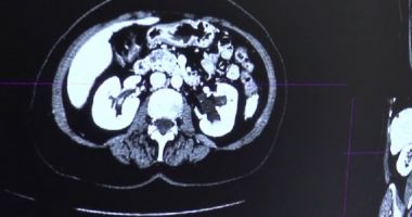 Stire din Social : Tinerii care revoluţionează sistemul medical din România. Ce au creat aceștia