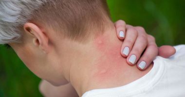 Stire din Social : Feriți-vă de țânțari! Virusul West Nile a făcut prima victimă la Constanța