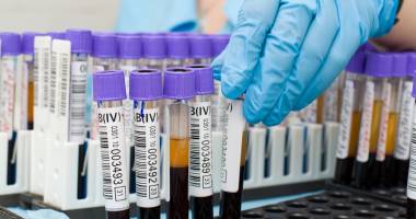 Ce înseamnă diagnosticul microbiologic