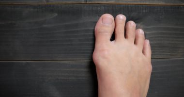 Stire din Sănătate : Atenție la încălțămintea pe care o purtați! Monturile pot fi dureroase