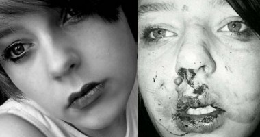 Stire din Eveniment : O tânără a fost mutilată de un grup de bătăuși. Află reacția fetei!