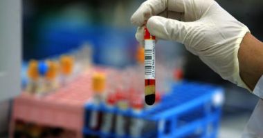 Stire din Social : Al treilea de caz de meningită în numai o săptămână