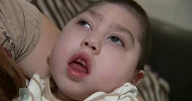 Stire din Diverse : Copilul născut fără creier a murit la vârsta de trei ani, din cauza unui virus!