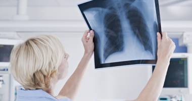Stire din Sănătate : Nu neglijați durerile din "capul pieptului"