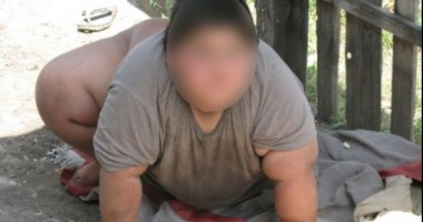 Stire din Eveniment : Copilul obez din Dolj a murit miercuri dimineața