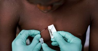 Stire din Actualitate : O boală nouă, extrem de contagioasă, face ravagii în SUA