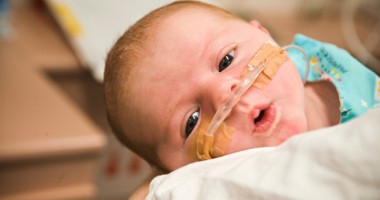 Stire din Sănătate : Operații gratuite pentru bebelușii  cu malformații congenitale