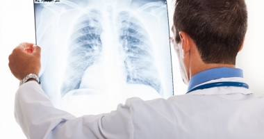 Drama pacienților cu cancer pulmonar. Diagnosticare tardivă și tratamente învechite