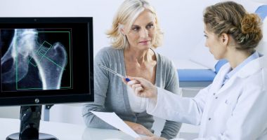 Stire din Sănătate : Ce alimente pot preveni instalarea precoce a osteoporozei