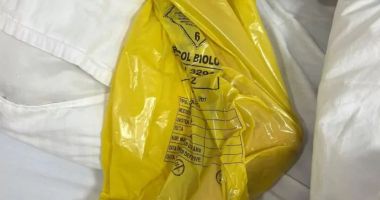 Stire din Social : O nouă anchetă într-un spital din România. Piciorul unui pacient învelit în pungă de gunoi