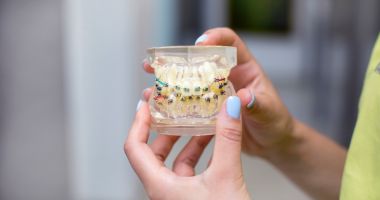 Stire din Sănătate : Aparatul dentar la copii: vârsta ideală, opțiuni disponibile și costuri estimate