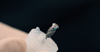 Stire din Sănătate : Servicii personalizate cu ajutorul tehnologiilor moderne. Cum reușește clinica Toldimed să aibă rezultate remarcabile
