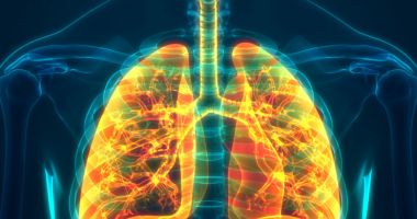 Stire din Actualitate : Studiu: Pacienții vindecați de Covid-19 rămân cu leziuni pulmonare după externare