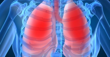 Stire din Sănătate : "Pneumonia face cele mai multe victime printre copii"