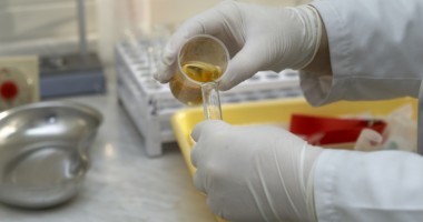 Stire din Sănătate : Descoperire revoluționară în medicină: specialiștii au oprit metastaza în cancerul de colon!
