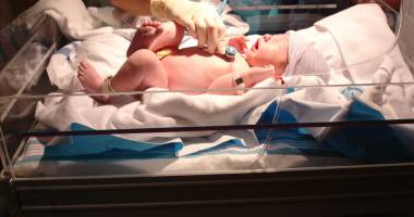 Stire din Sănătate : Premieră medicală: primul transplant de cutie craniană, realizat cu succes